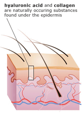 hyaluronic-acid-cream